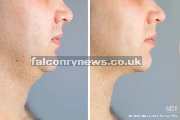 how to get rid of double chin